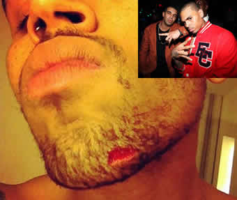 Chris Brown and Drake's Fight