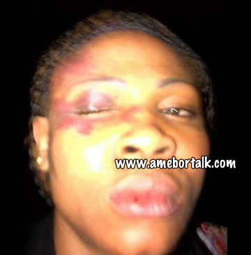 K-Solo's Wife Beaten Up
