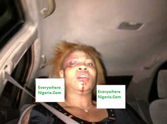 Ksolo Wife Beaten Up