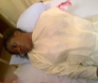 Mercy Johnson Loses Arm